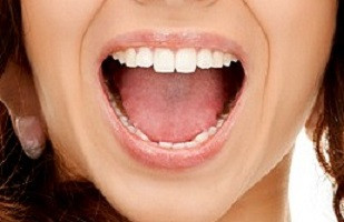 jak uniknąć dziur w zębach